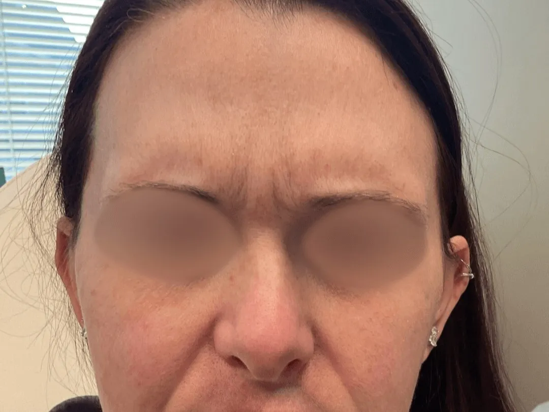 WrinkleWrinkle