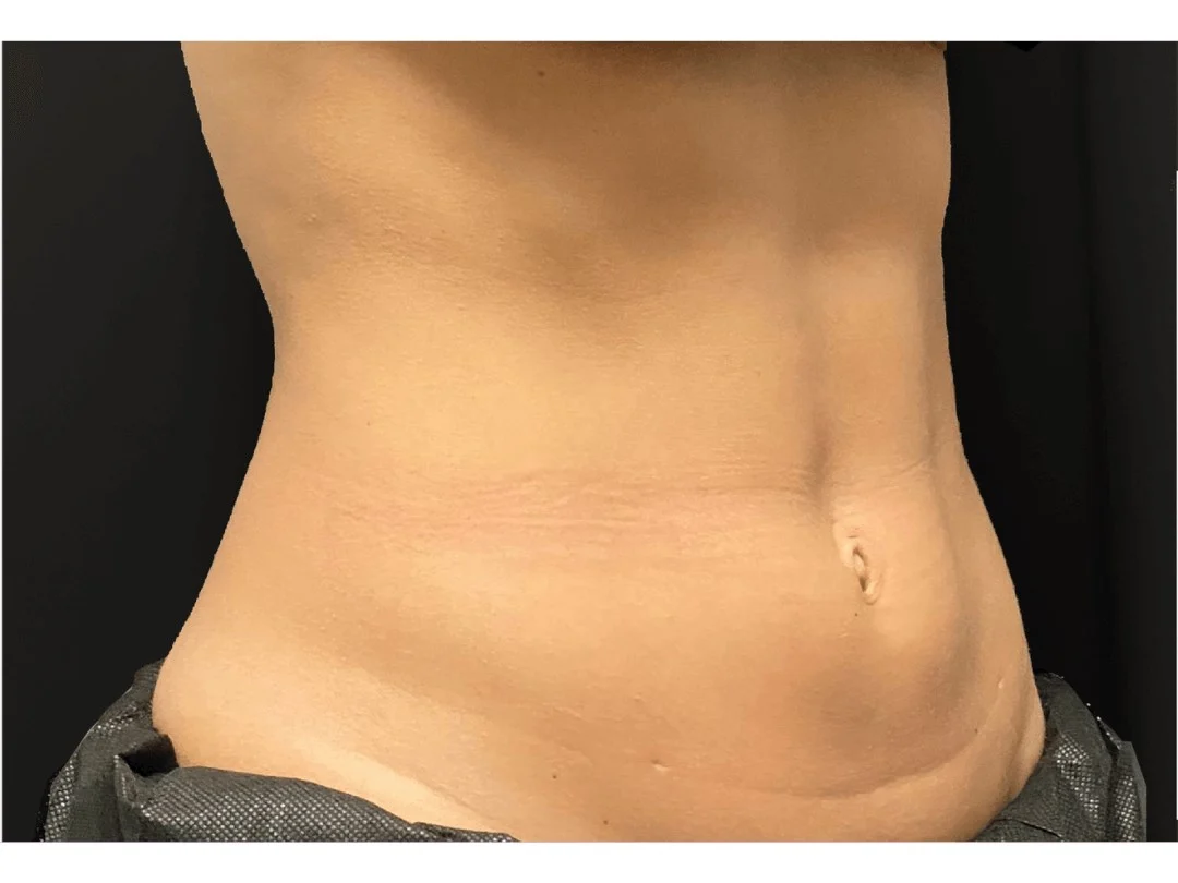 Slims Waistline