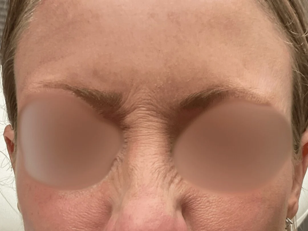 Wrinkle