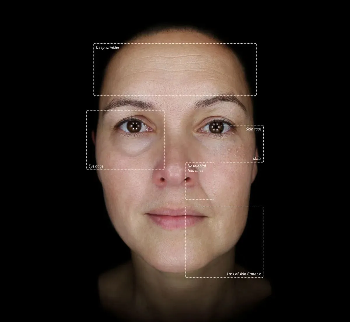 Alma IQ Skin Analysis