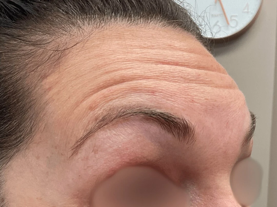 Wrinkle