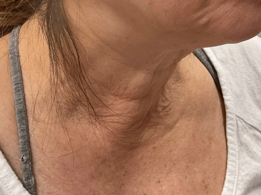Woman Tightens