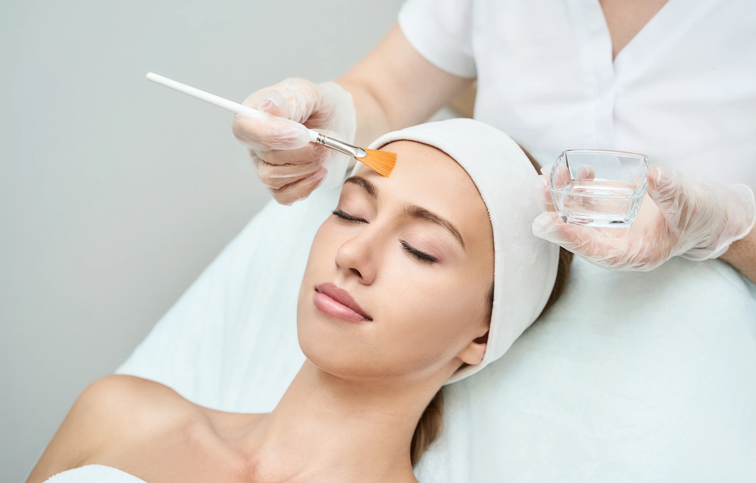 Chemical Peels