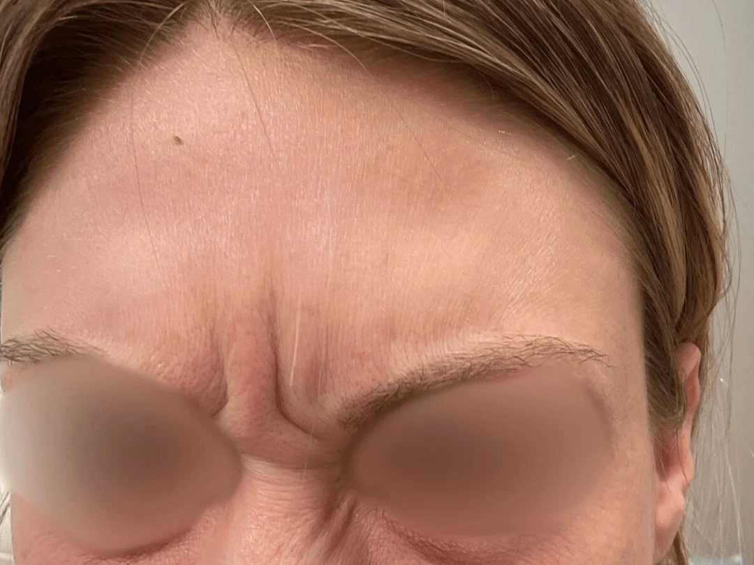 Wrinkle
