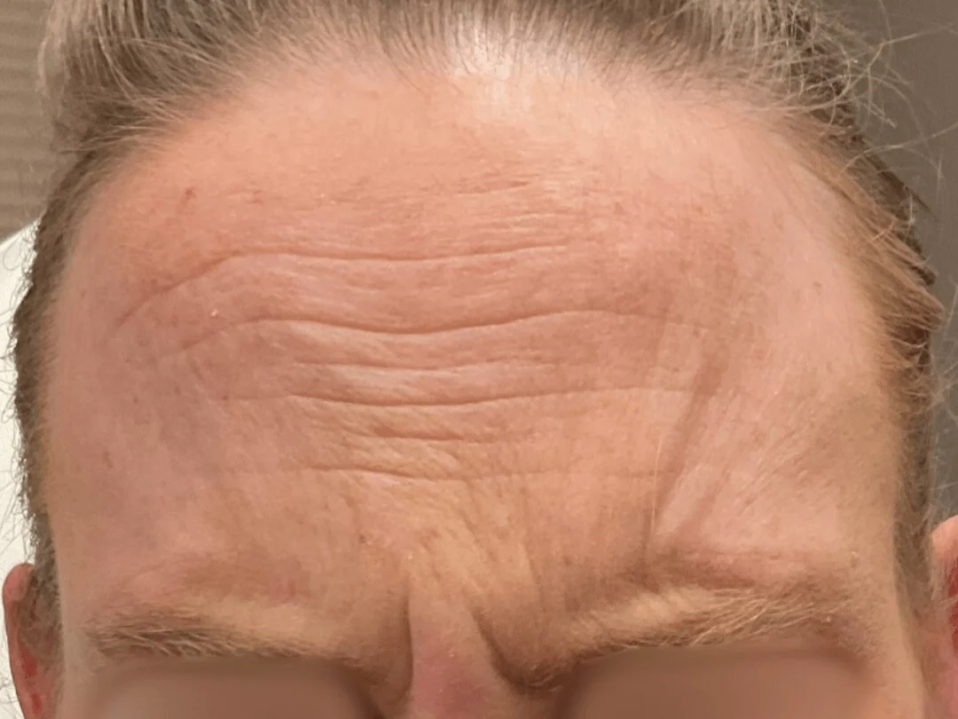 Wrinkle
