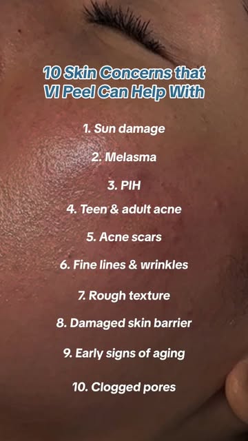 Is healthier skin one of your 2026 goals? VI Peel treats:  1. Sun damage   2....
