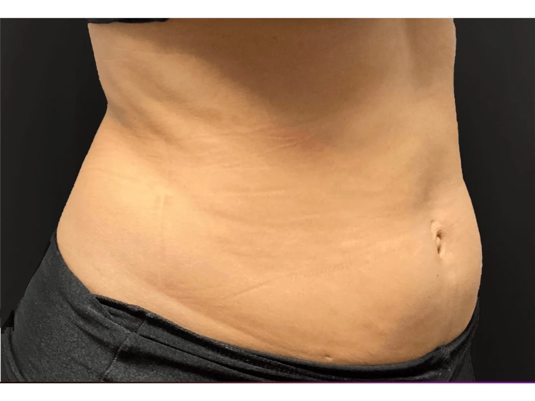 Slims Waistline
