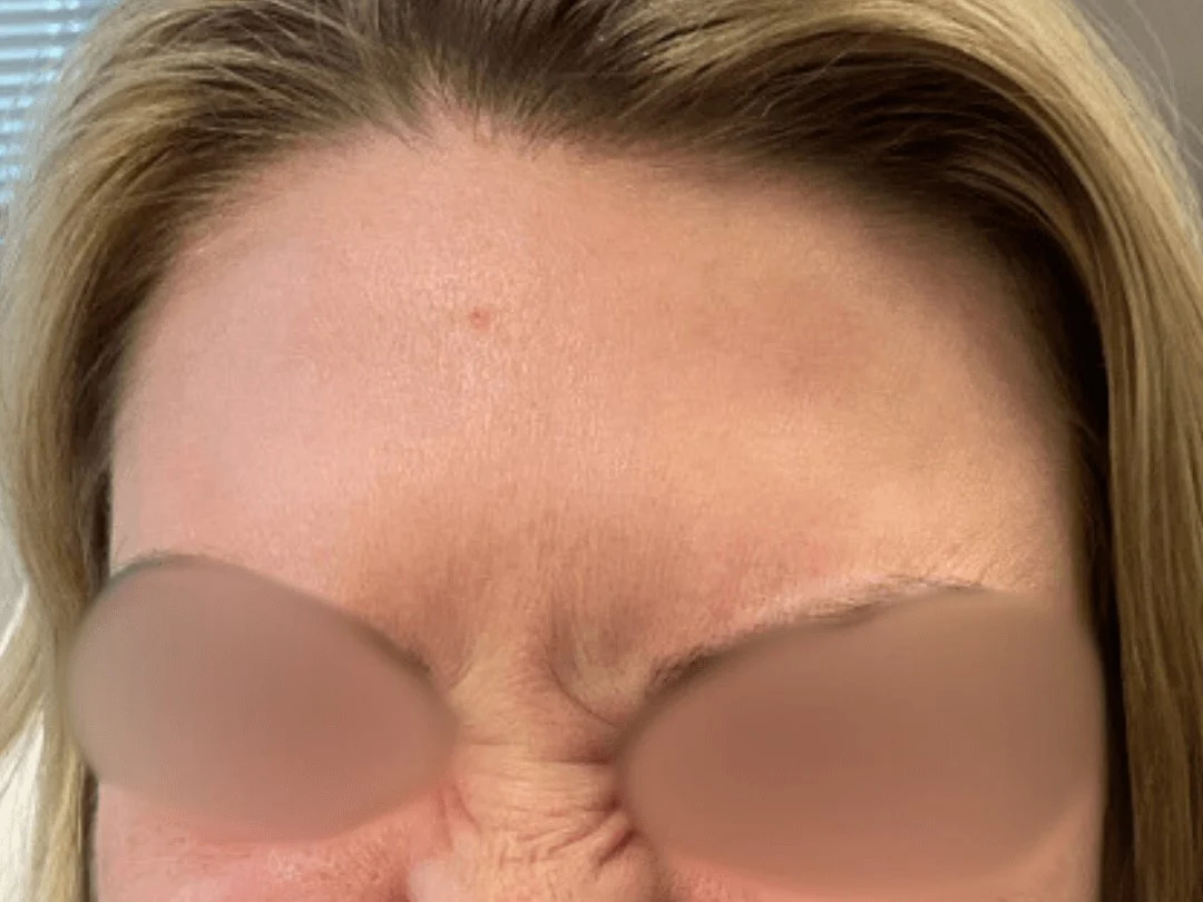 Wrinkle