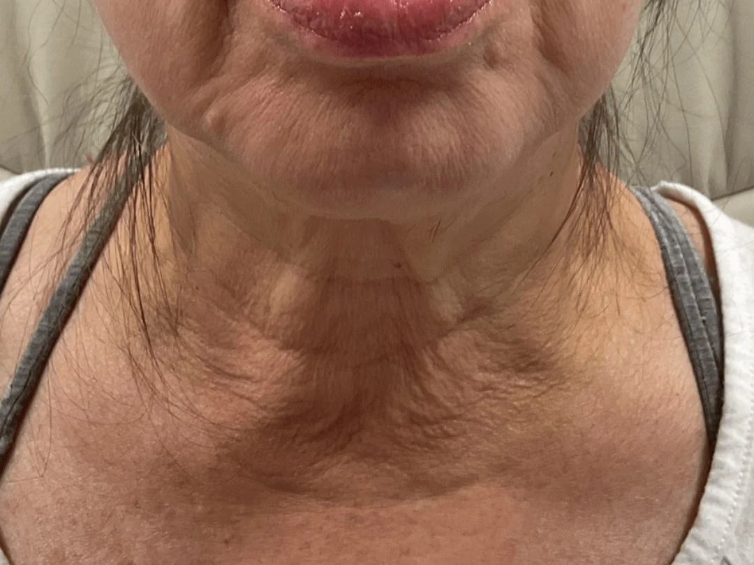 Woman Tightens