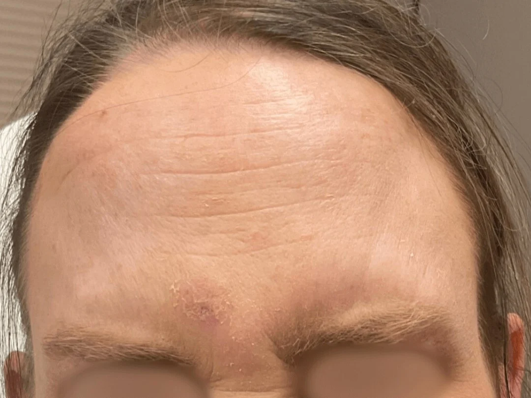Wrinkle