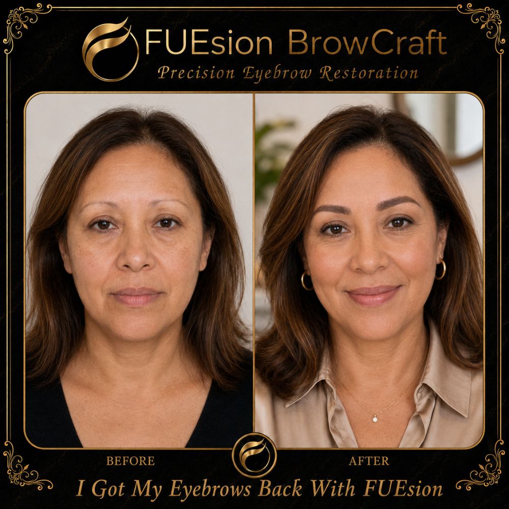 Pencil-thin brow correction before and after — FUEsion BrowCraft