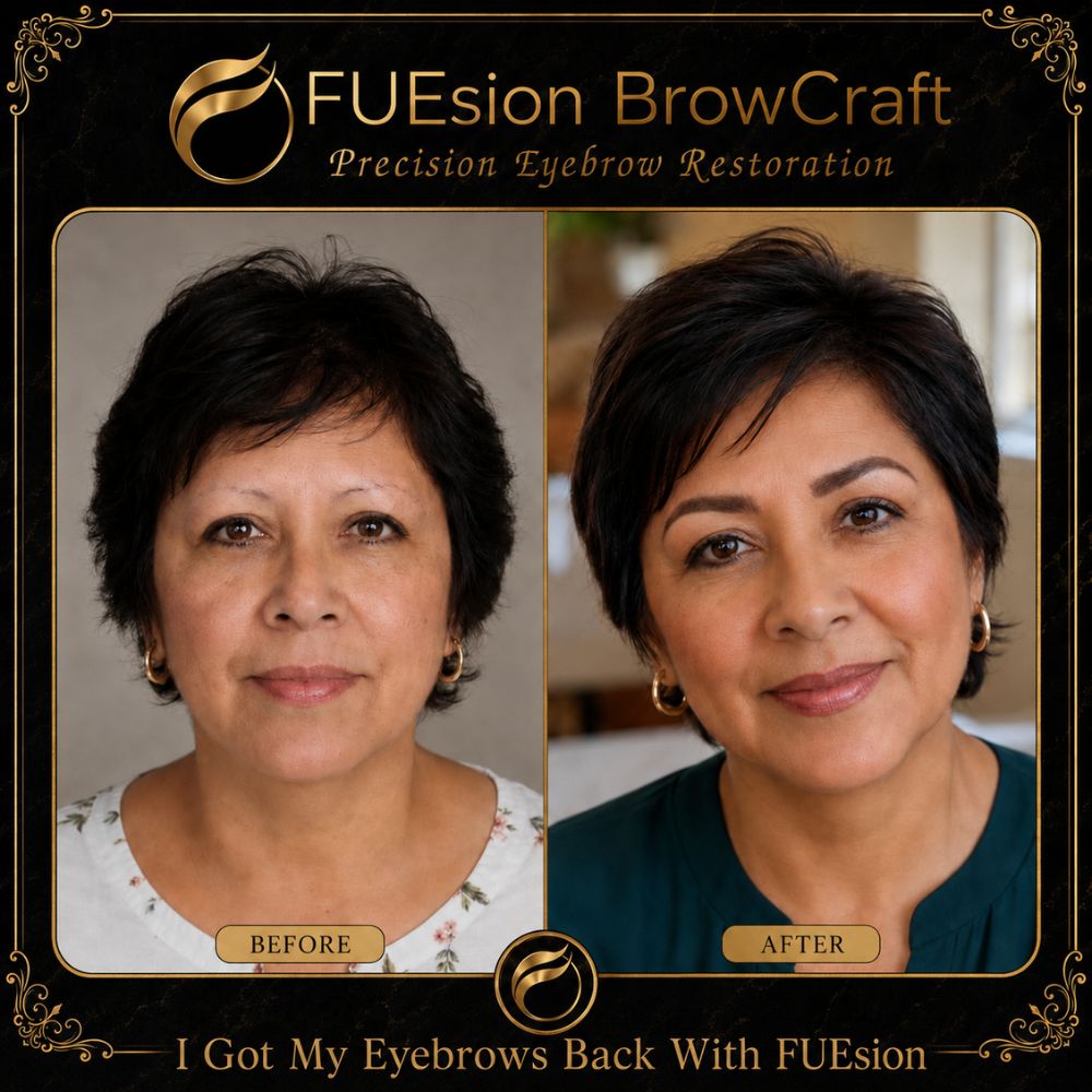 Trichotillomania brow restoration before and after — FUEsion BrowCraft