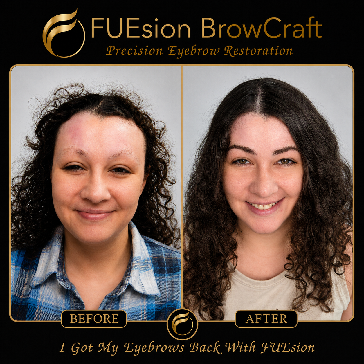 Burn scar brow concealment before and after — FUEsion BrowCraft