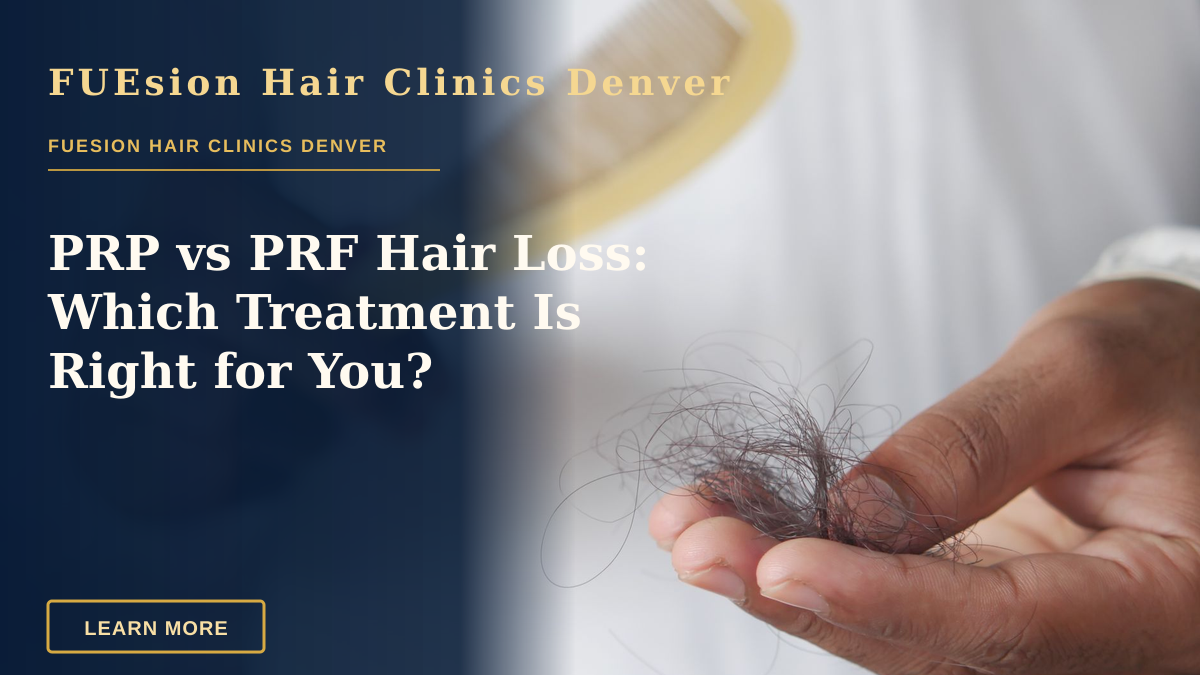 PRP vs PRF Hair Loss: Which Treatment Is Right for You? — A detailed image showing hair loss with a comb in hand, symbolizing alopecia and related issues.
