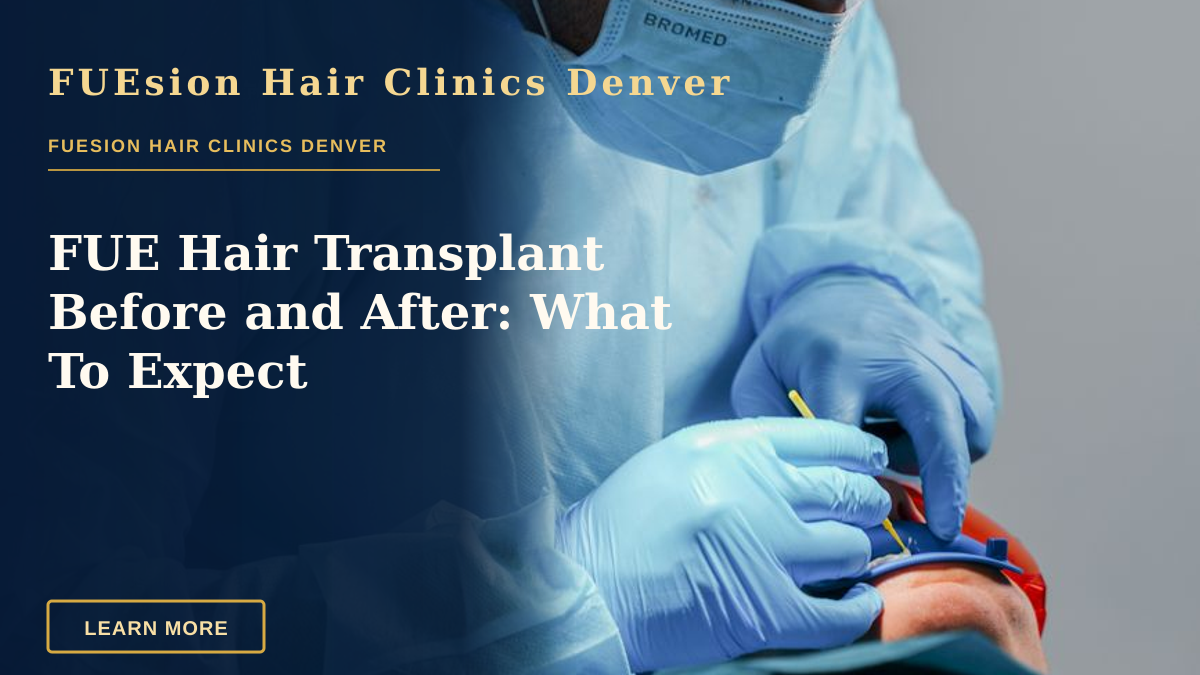 FUE Hair Transplant Before and After: What To Expect — A dentist performing a complex dental procedure using modern surgical equipment.