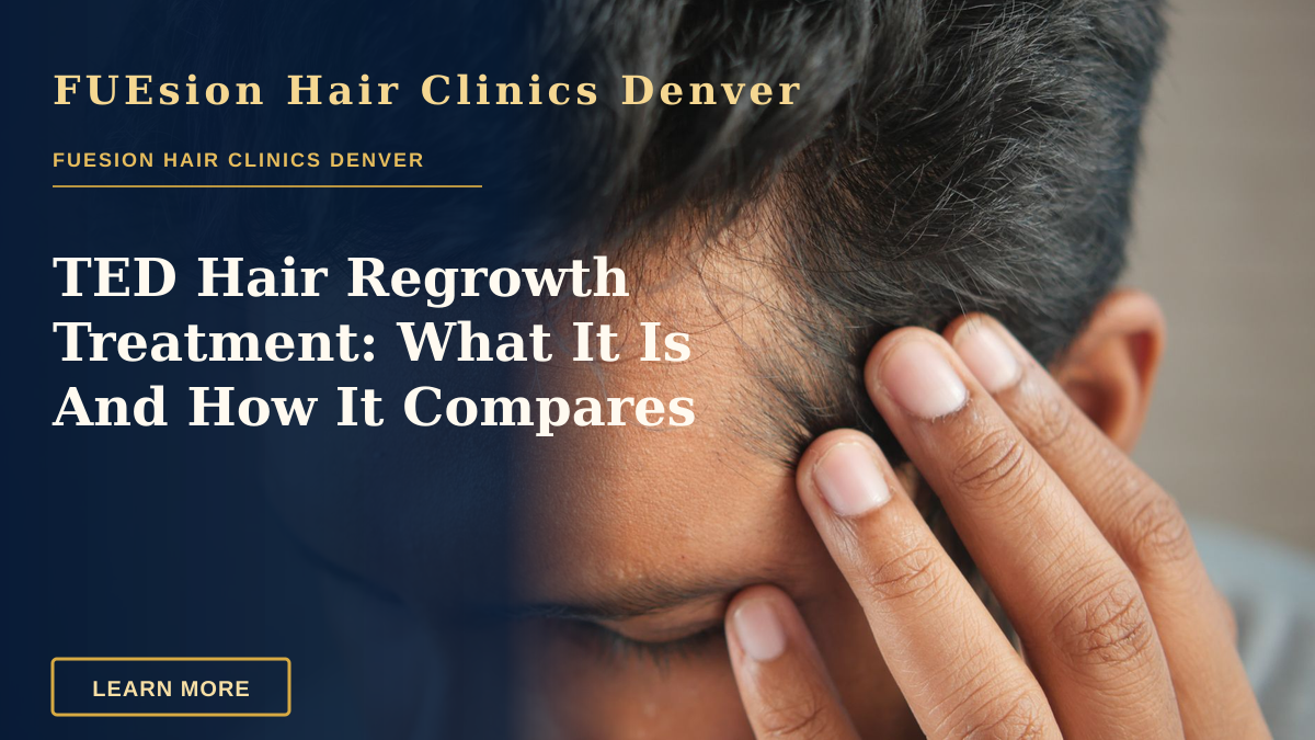 TED Hair Regrowth Treatment: What It Is And How It Compares — Close-up of a man's hand touching his head in contemplation. Neutral tones and soft lighting.