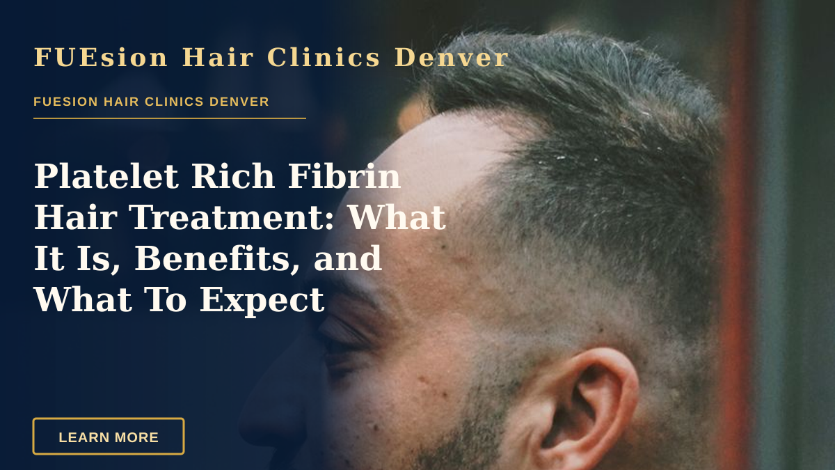 Platelet Rich Fibrin Hair Treatment: What It Is, Benefits, and What To Expect — Close-up side view of a bearded man in a floral shirt gazing into the distance indoors.