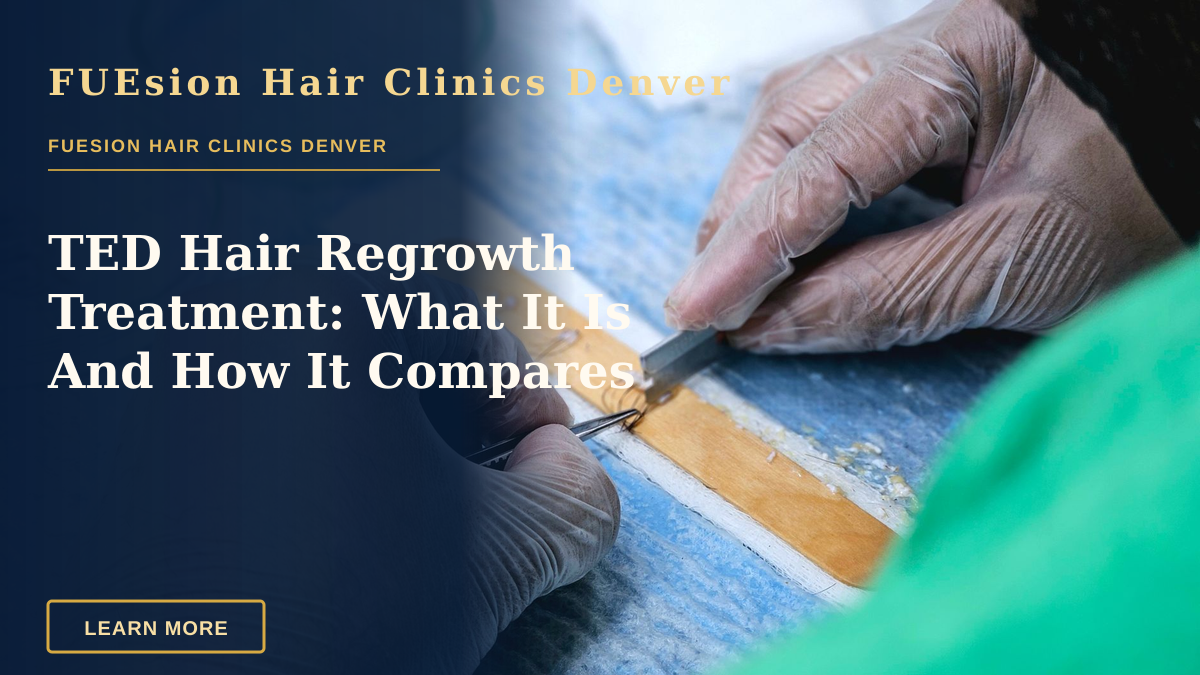 TED Hair Regrowth Treatment: What It Is And How It Compares — Detailed view of a hair transplant procedure with gloved hands holding surgical tools indoors.