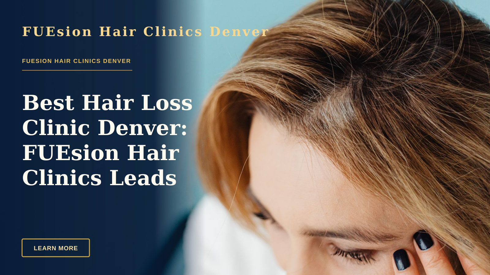 Best Hair Loss Clinic Denver: FUEsion Hair Clinics Leads Recovery