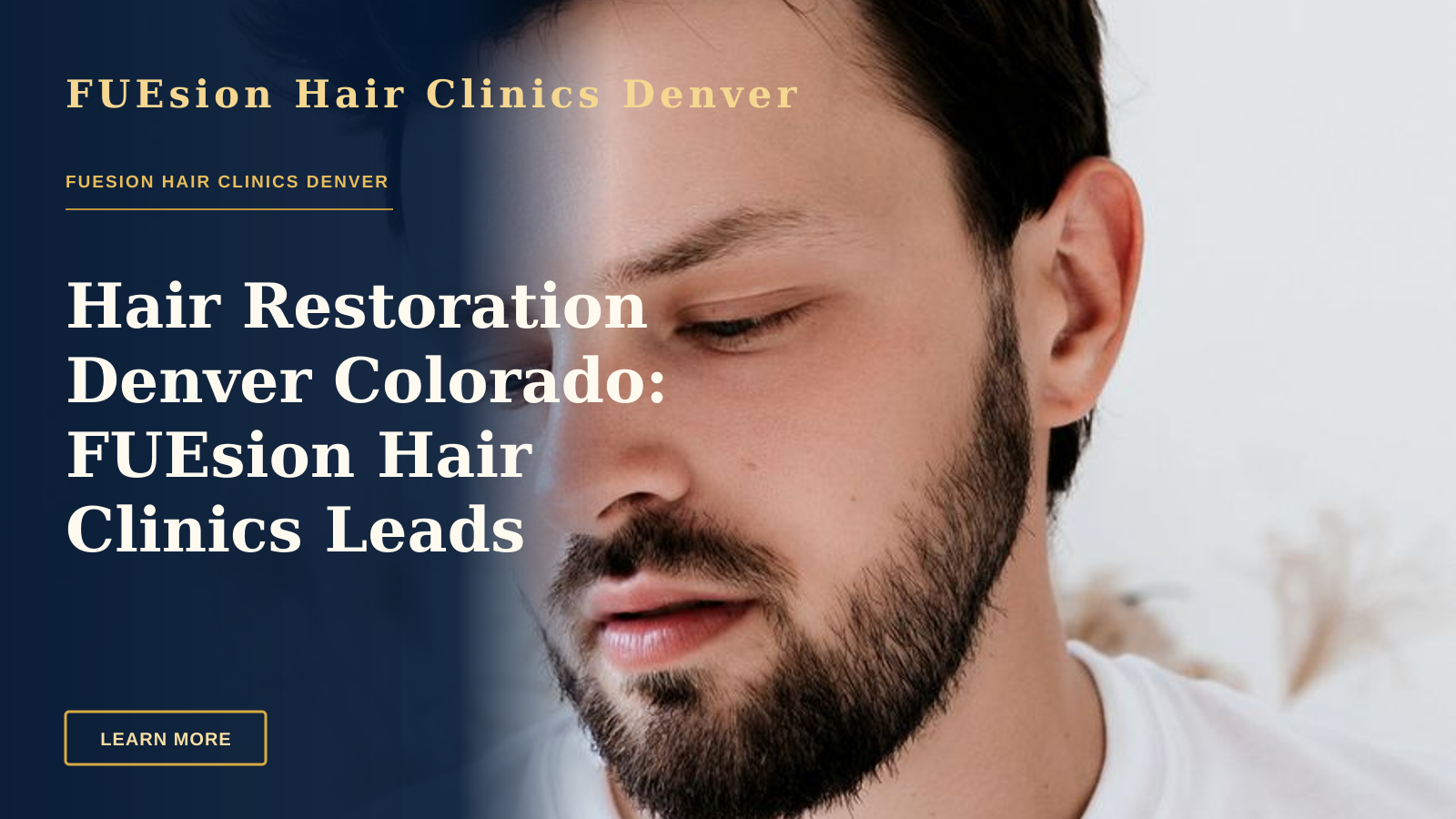 Hair Restoration Denver Colorado: FUEsion Hair Clinics Leads