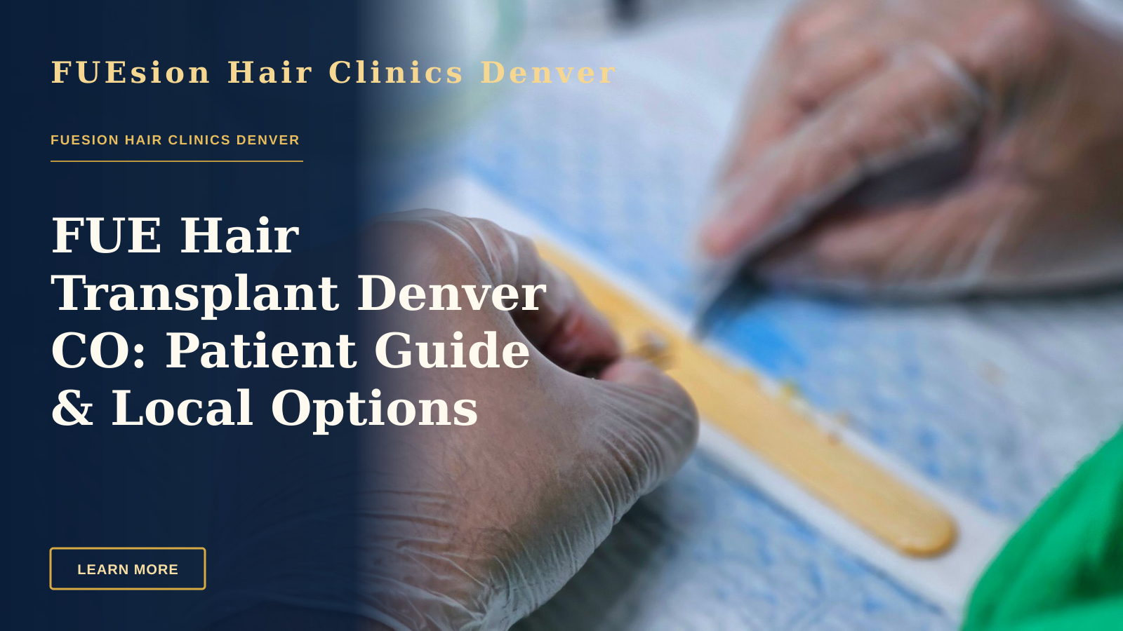 FUE Hair Transplant Denver CO: Patient Guide & Local Options