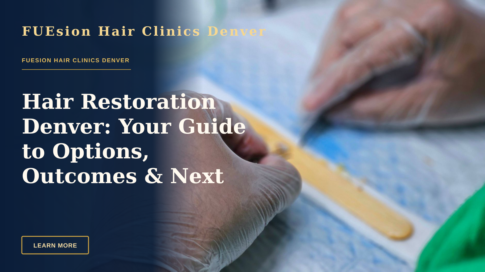 Hair Restoration Denver: Your Guide to Options, Outcomes & Next Steps — Detailed view of hair graft preparation during a hair transplant surgery.