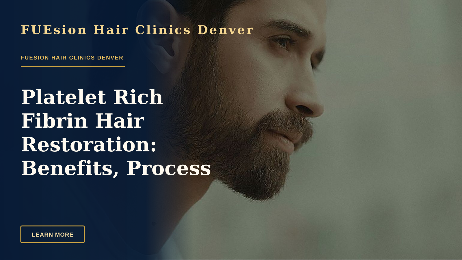 Platelet Rich Fibrin Hair Restoration: Benefits, Process & Results — Side profile of a bearded man in an artistic setting, capturing a thoughtful expression.