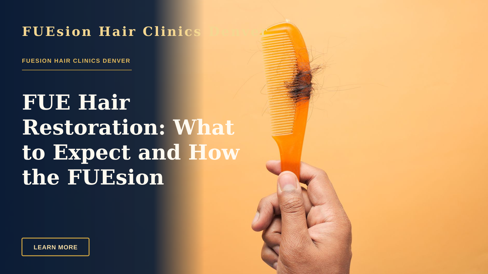 FUE Hair Restoration: What to Expect and How the FUEsion Approach Works