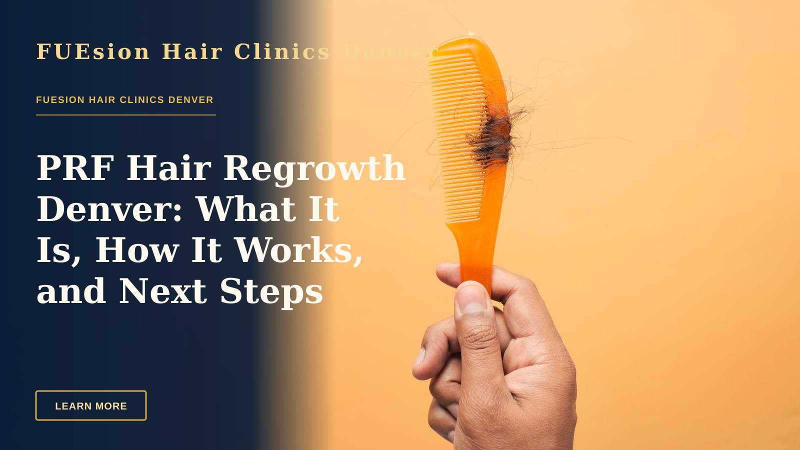 PRF Hair Regrowth Denver: What It Is, How It Works, and Next Steps