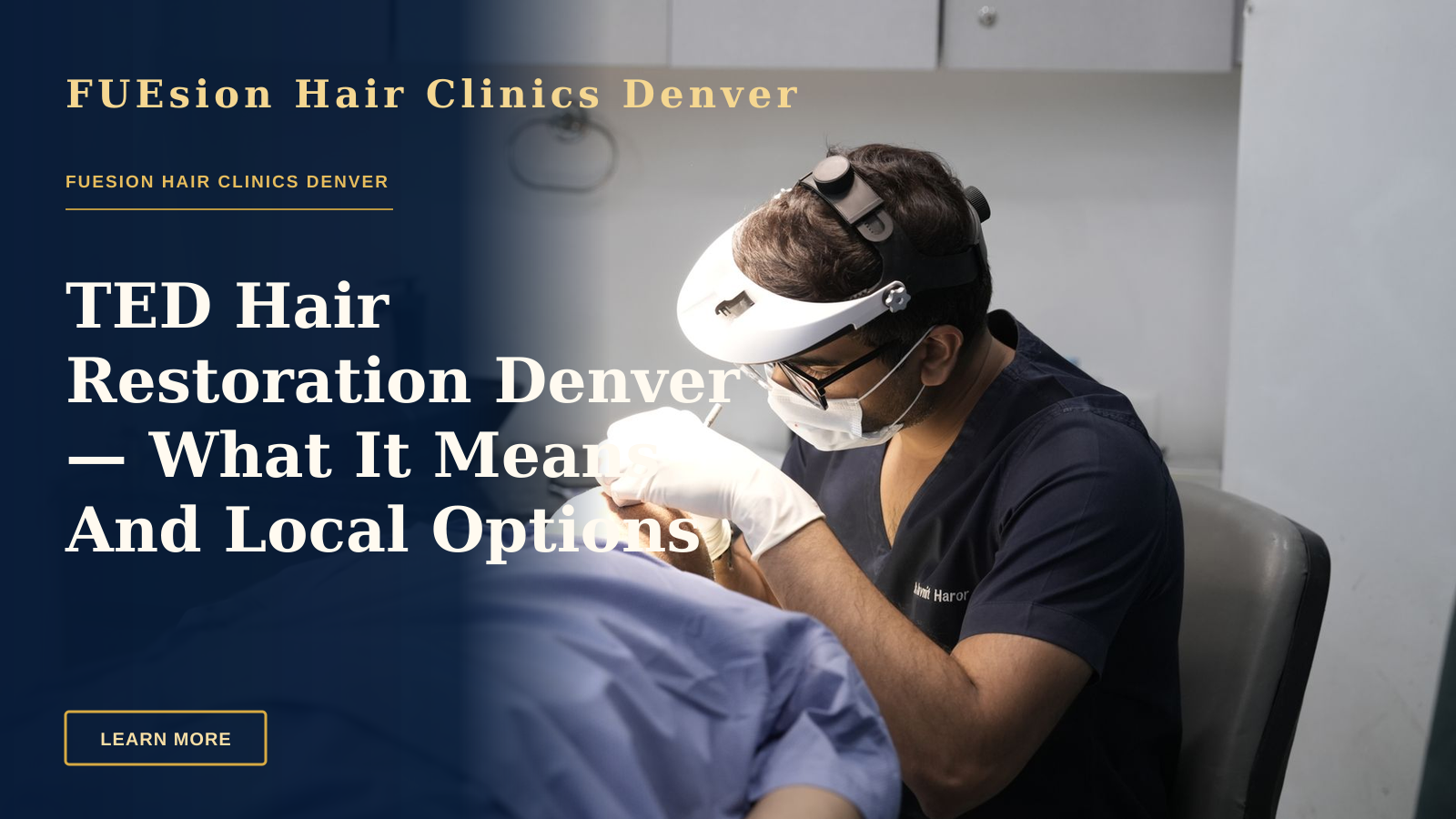 TED Hair Restoration Denver — What It Means And Local Options