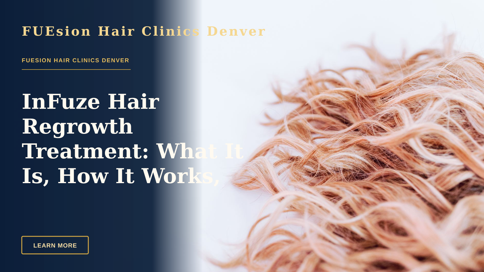 InFuze Hair Regrowth Treatment: What It Is, How It Works, and Who It's For