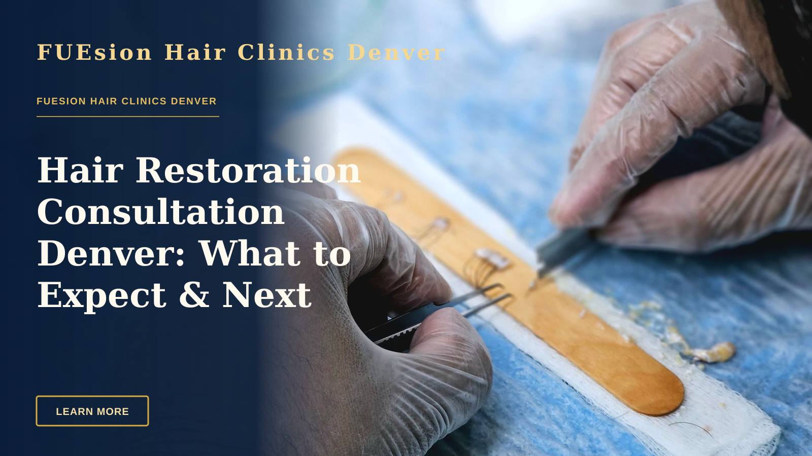 Hair Restoration Consultation Denver: What to Expect & Next Steps — Close-up of surgeons preparing hair grafts for transplantation, demonstrating precise skills.
