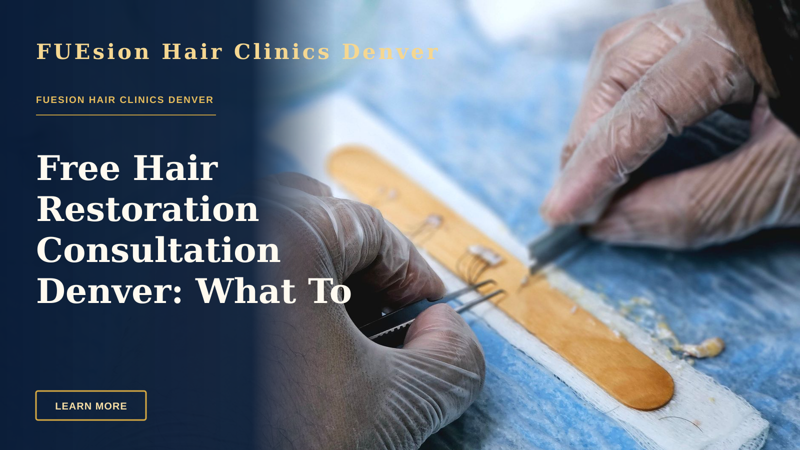 Free Hair Restoration Consultation Denver: What To Expect — Close-up of surgeons preparing hair grafts for transplantation, demonstrating precise skills.