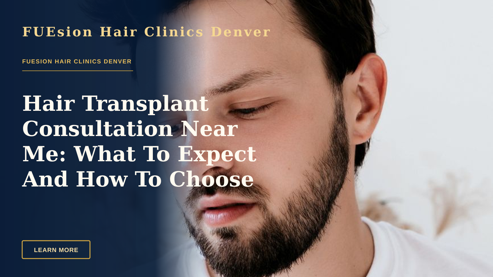 Hair Transplant Consultation Near Me: What To Expect And How To Choose