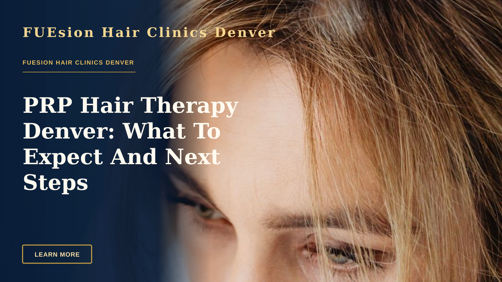 PRP Hair Therapy Denver: What To Expect And Next Steps