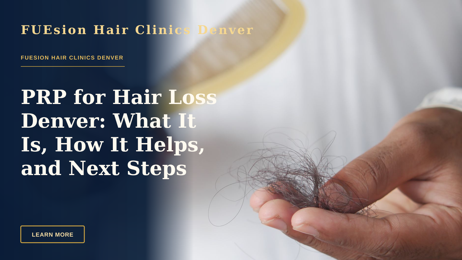 PRP for Hair Loss Denver: What It Is, How It Helps, and Next Steps