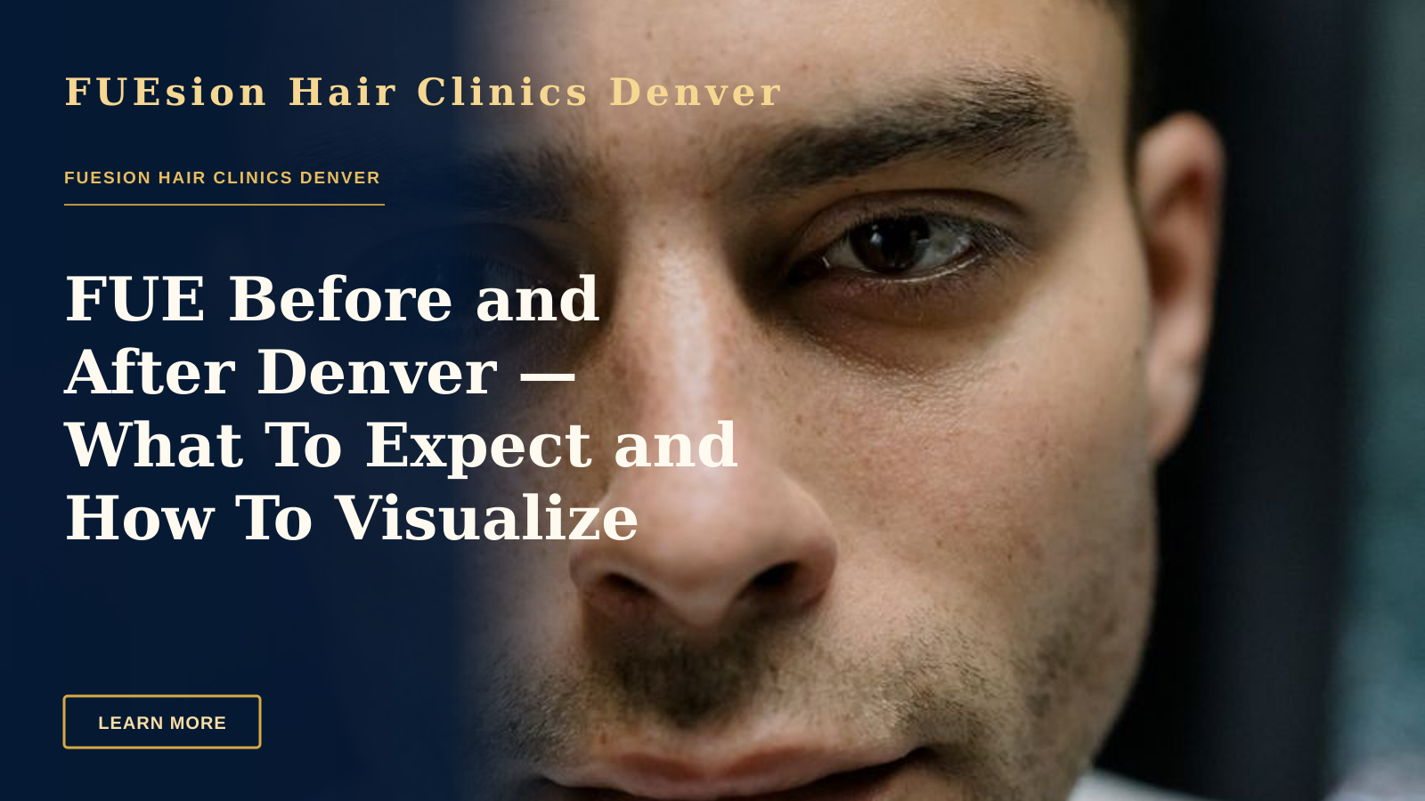 FUE Before and After Denver — What To Expect and How To Visualize Results
