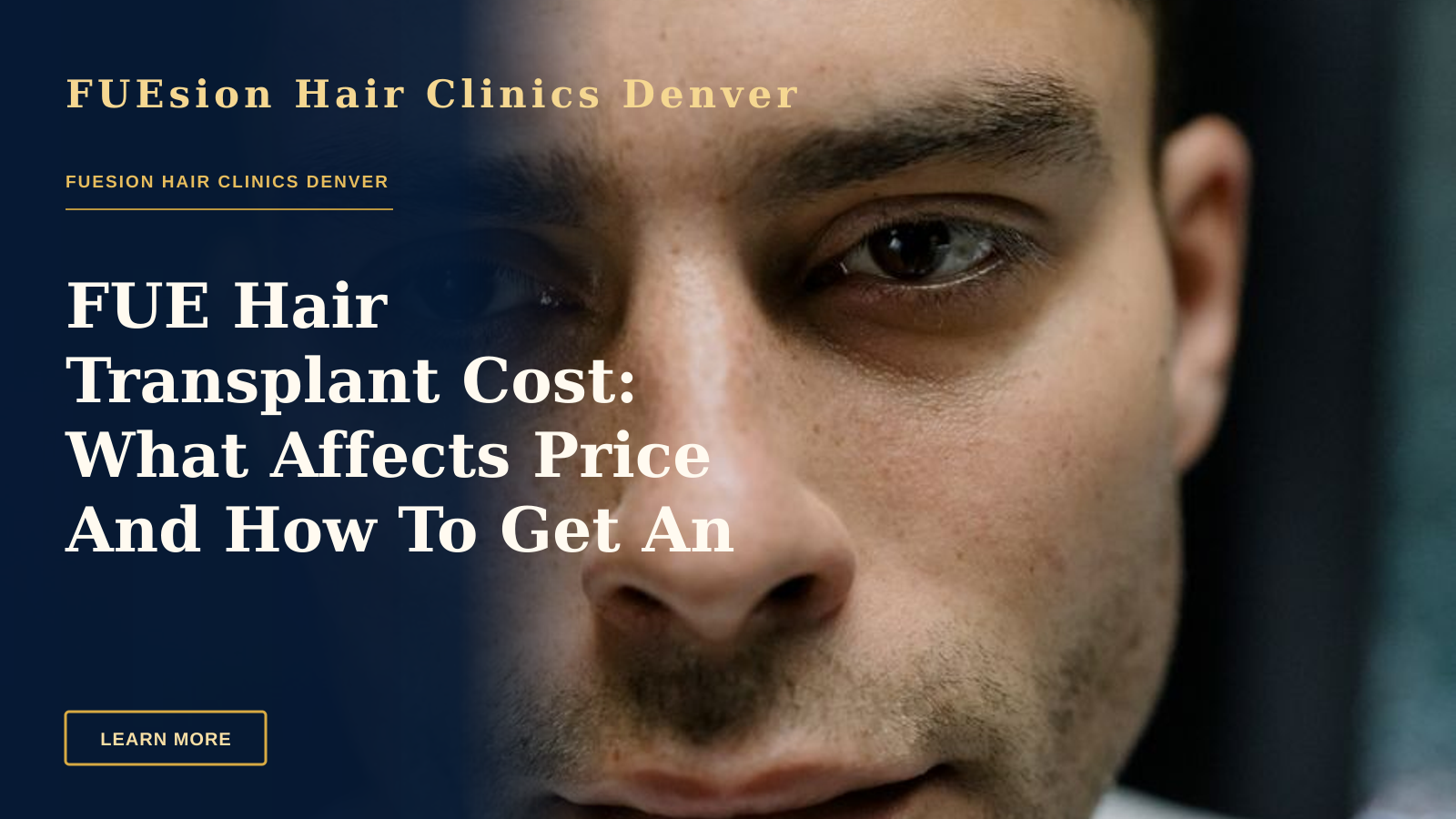 FUE Hair Transplant Cost: What Affects Price And How To Get An Estimate