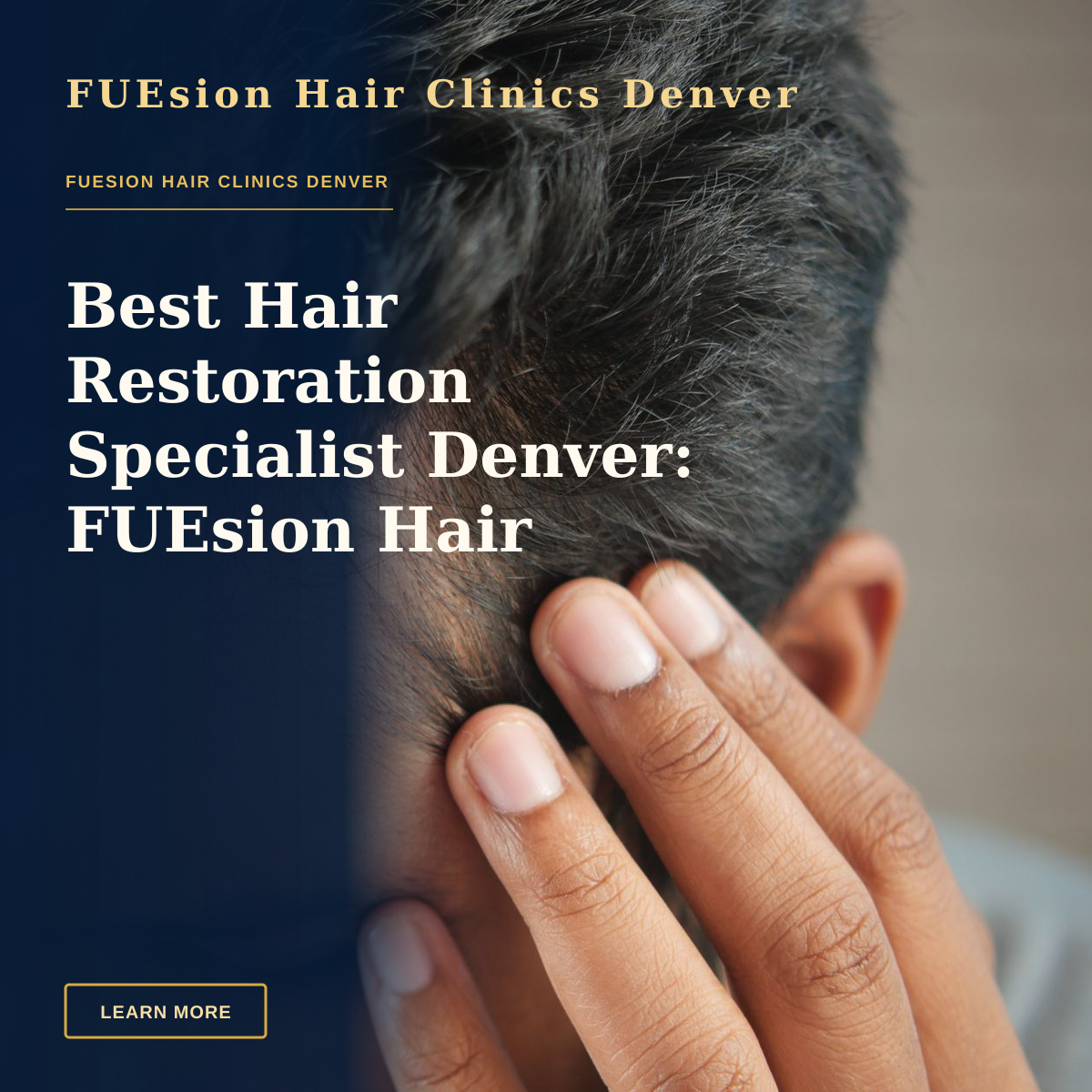 Best Hair Restoration Specialist Denver: FUEsion Hair Clinics Leader — Close-up of a man's hand touching his head in contemplation. Neutral tones and soft lighting.