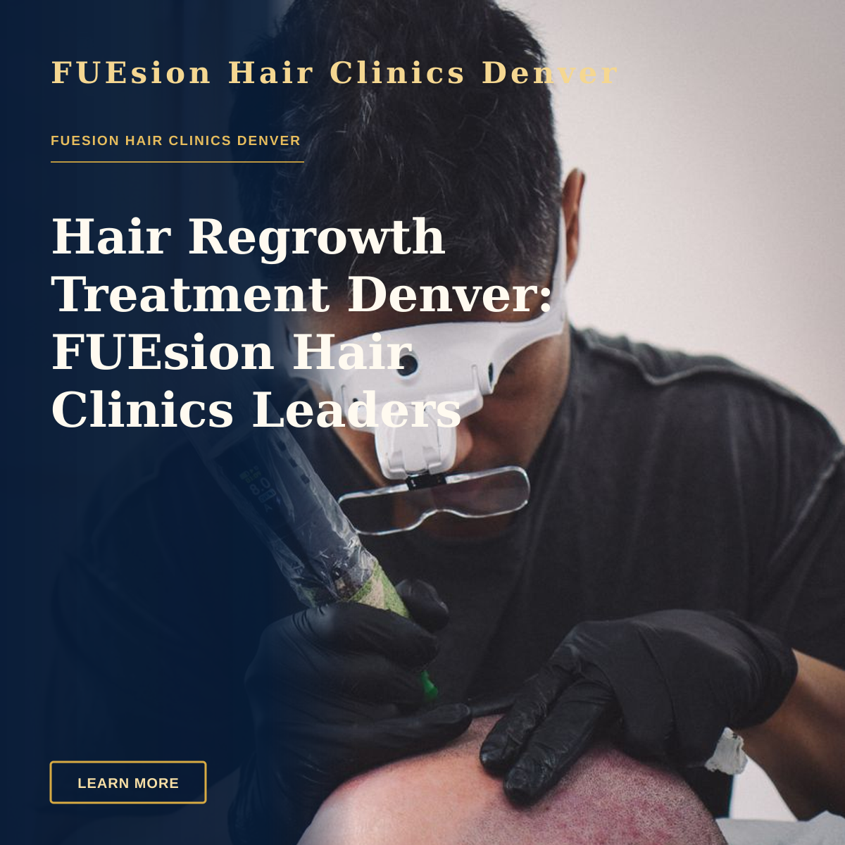 Hair Regrowth Treatment Denver: FUEsion Hair Clinics Leaders — A skilled tattoo artist performing scalp micropigmentation on a client's head.