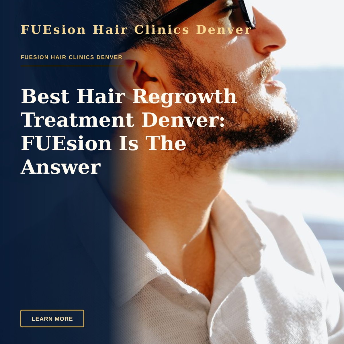 Best Hair Regrowth Treatment Denver: FUEsion Is The Answer — Side profile of a man in sunglasses, captured in natural light, conveying a relaxed mood.