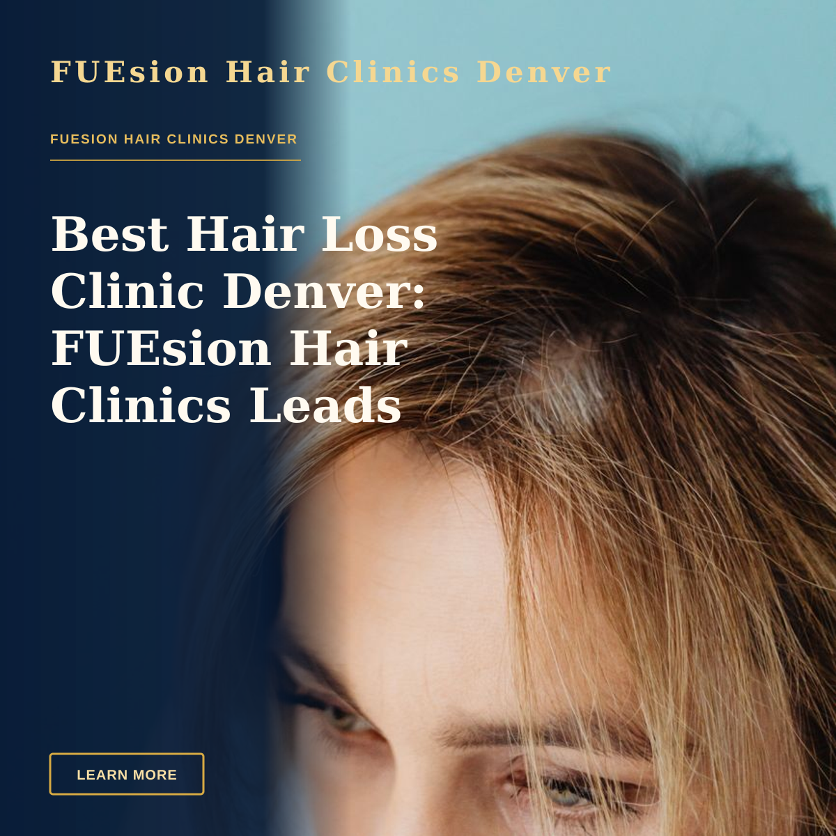 Best Hair Loss Clinic Denver: FUEsion Hair Clinics Leads Recovery — Studio shot of a woman's head with blonde hair against a blue background, focusing on her eyes and forehead.