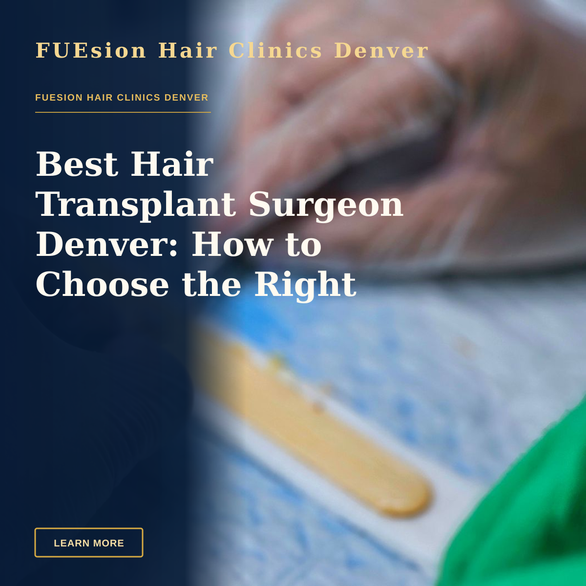 Best Hair Transplant Surgeon Denver: How to Choose the Right Expert — Detailed view of hair graft preparation during a hair transplant surgery.