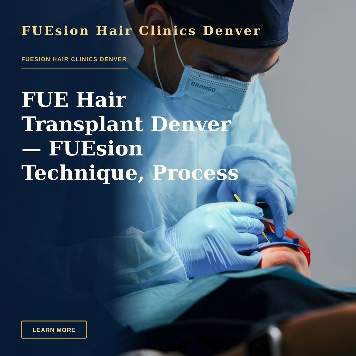 FUE Hair Transplant Denver — FUEsion Technique, Process & Next Steps — A dentist performing a complex dental procedure using modern surgical equipment.