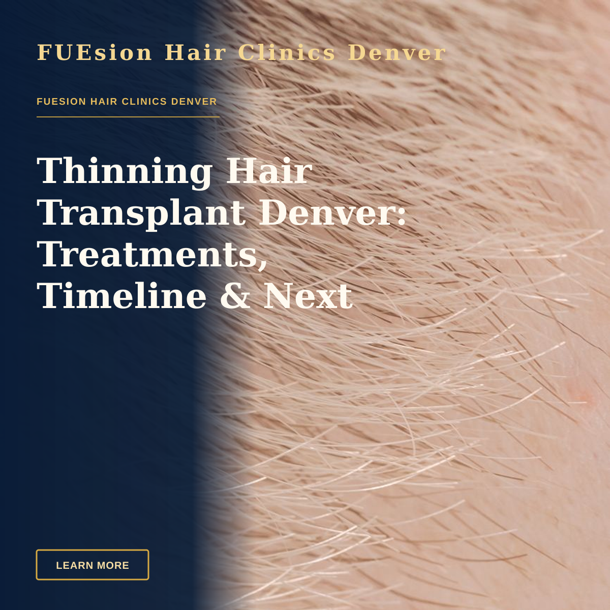 Thinning Hair Transplant Denver: Treatments, Timeline & Next Steps — Full frame closeup of skin with short brown and fair hairs on surface