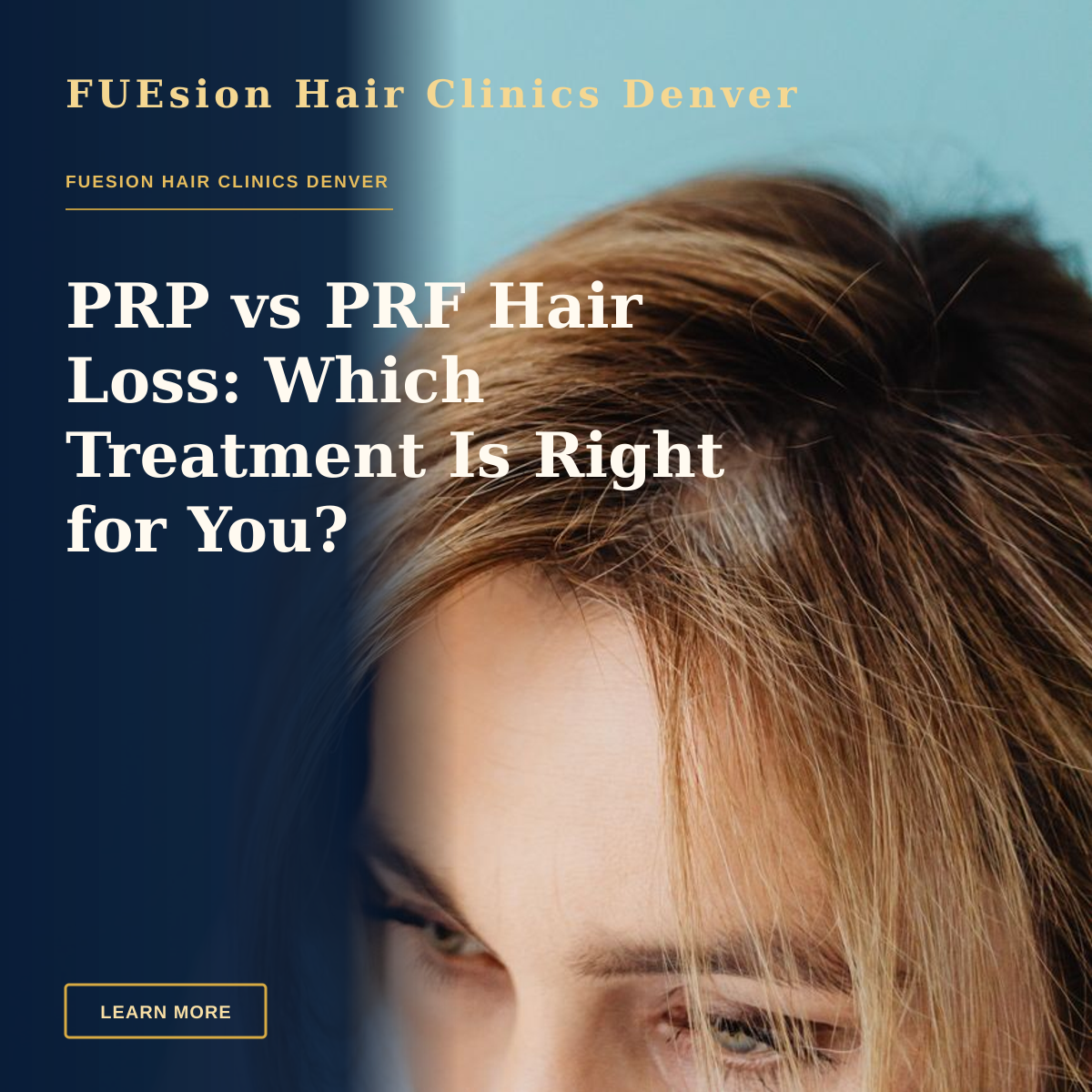 PRP vs PRF Hair Loss: Which Treatment Is Right for You? — Studio shot of a woman's head with blonde hair against a blue background, focusing on her eyes and forehead.