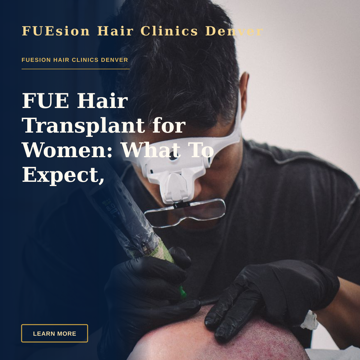 FUE Hair Transplant for Women: What To Expect, Eligibility, and Next Steps — A skilled tattoo artist performing scalp micropigmentation on a client's head.