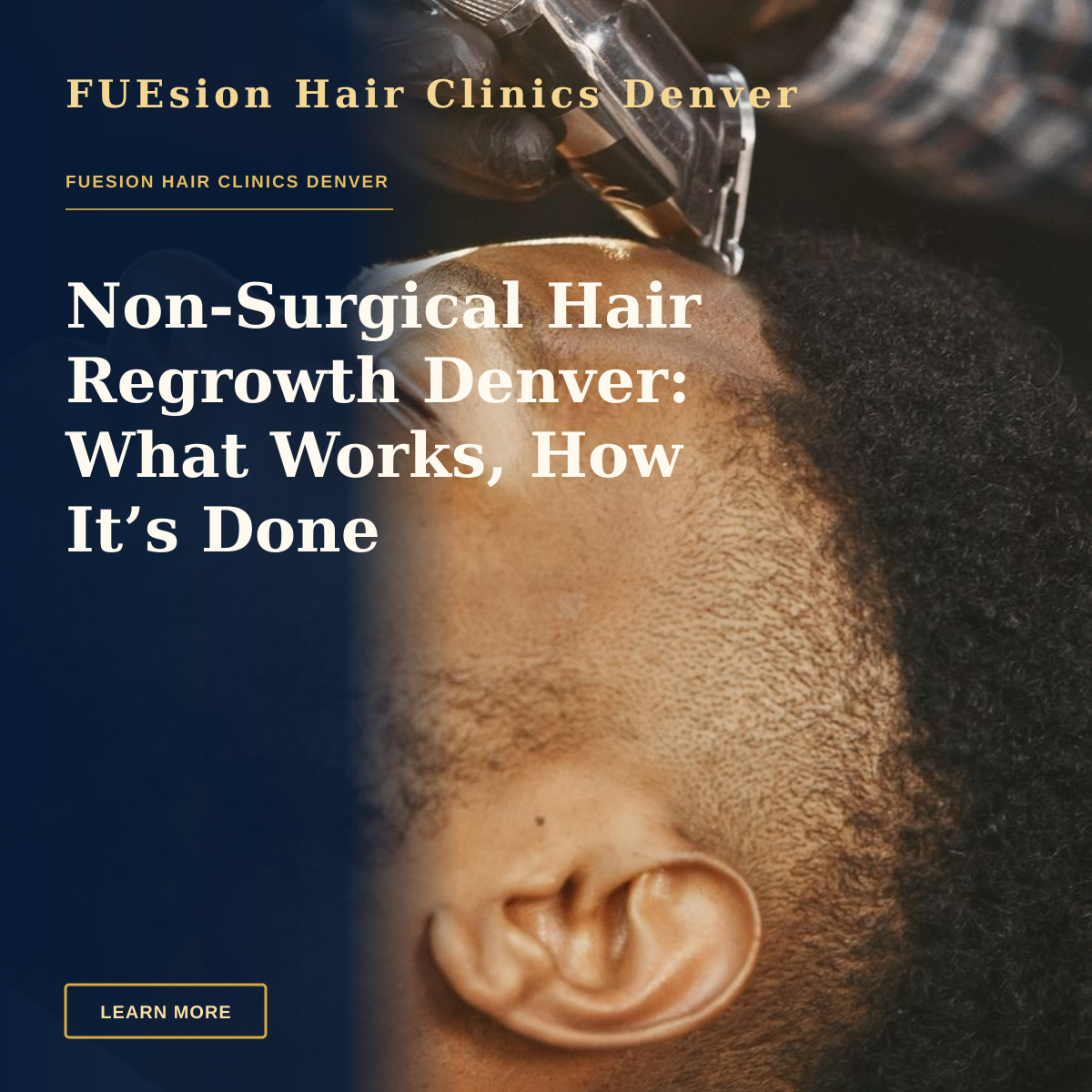 Non-Surgical Hair Regrowth Denver: What Works, How It’s Done — African American man receives a precise haircut with a hair clipper. Close-up view.
