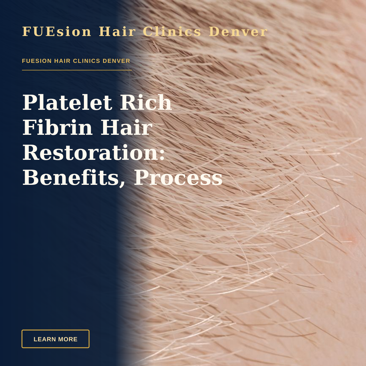 Platelet Rich Fibrin Hair Restoration: Benefits, Process & Results — Full frame closeup of skin with short brown and fair hairs on surface