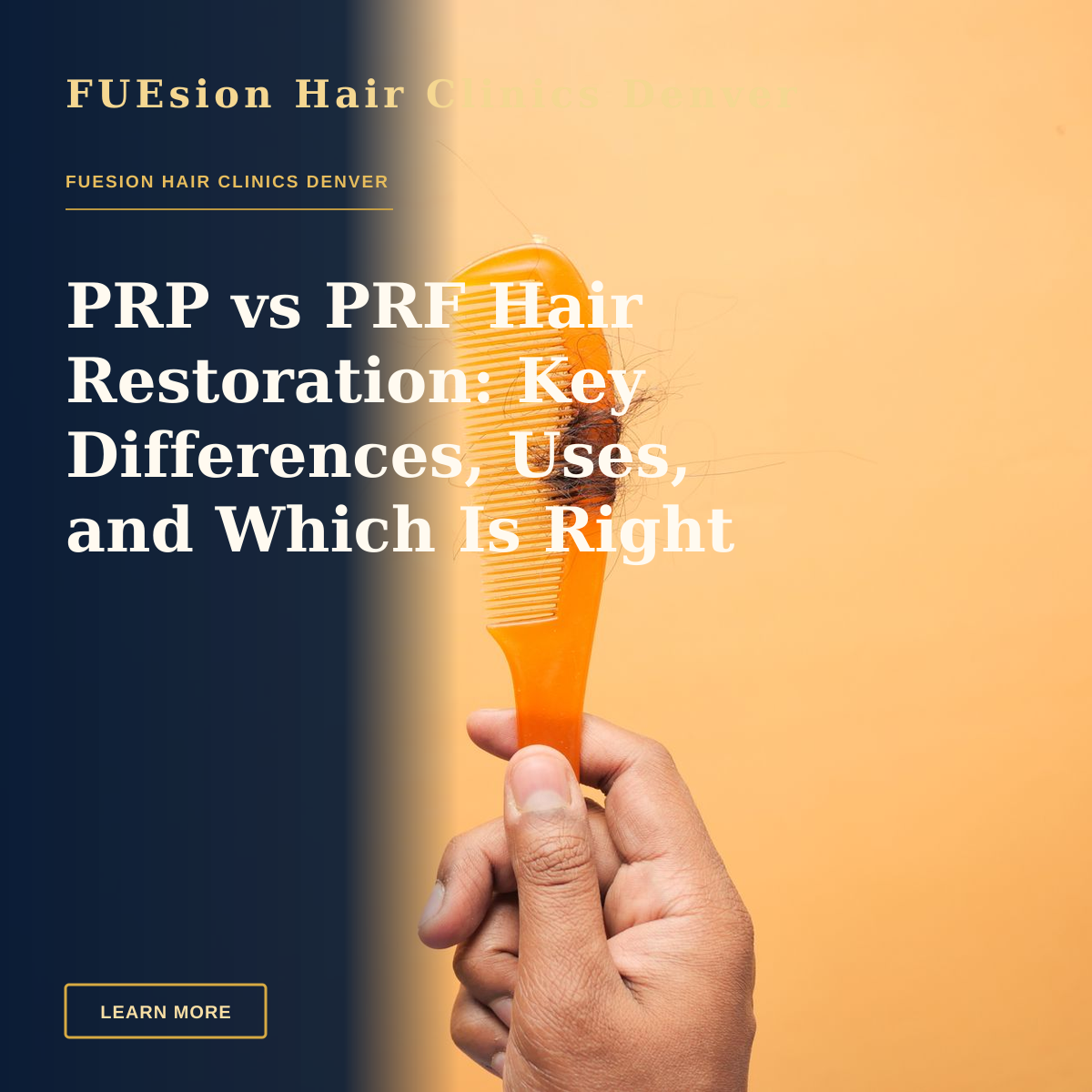 PRP vs PRF Hair Restoration: Key Differences, Uses, and Which Is Right For You — Close-up of hand holding a comb with hair against an orange backdrop, highlighting hair loss concept.